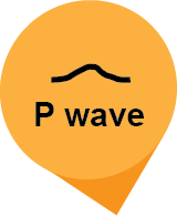 Overlay Visualization